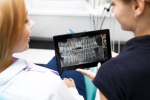 Tecnologie avanzate negli impianti dentali: un approfondimento